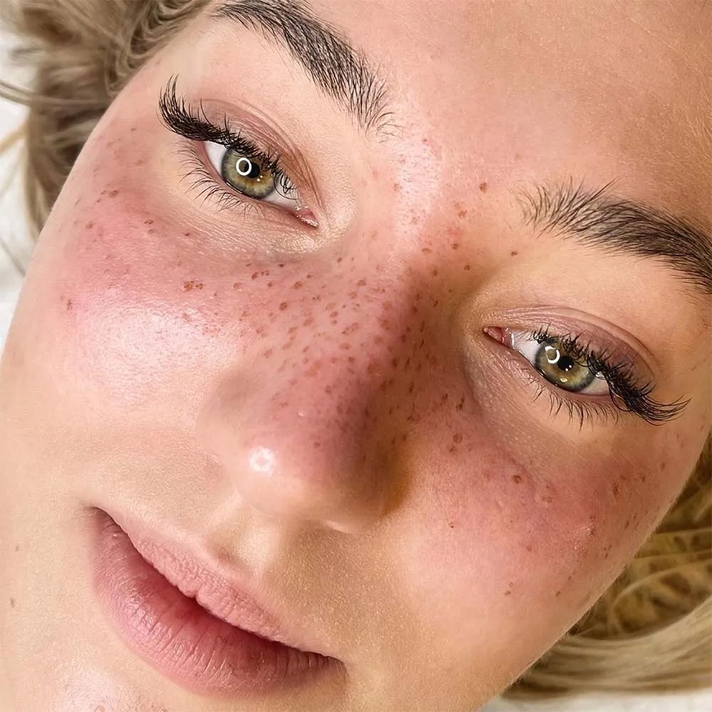 Freckle Tattoo