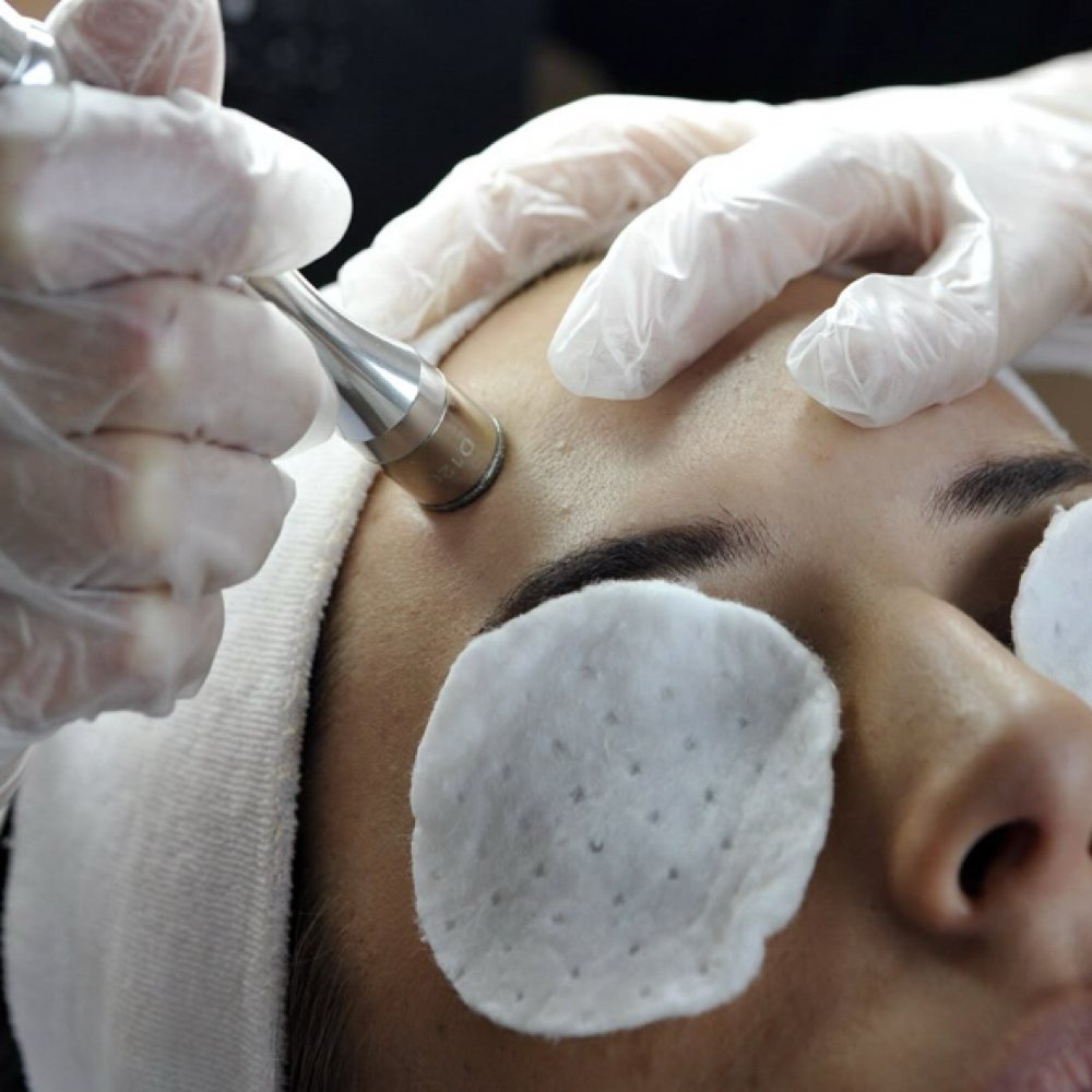 Microdermabrasion Facial at Haylee Jade Esthetics LLC in Ellijay, GA