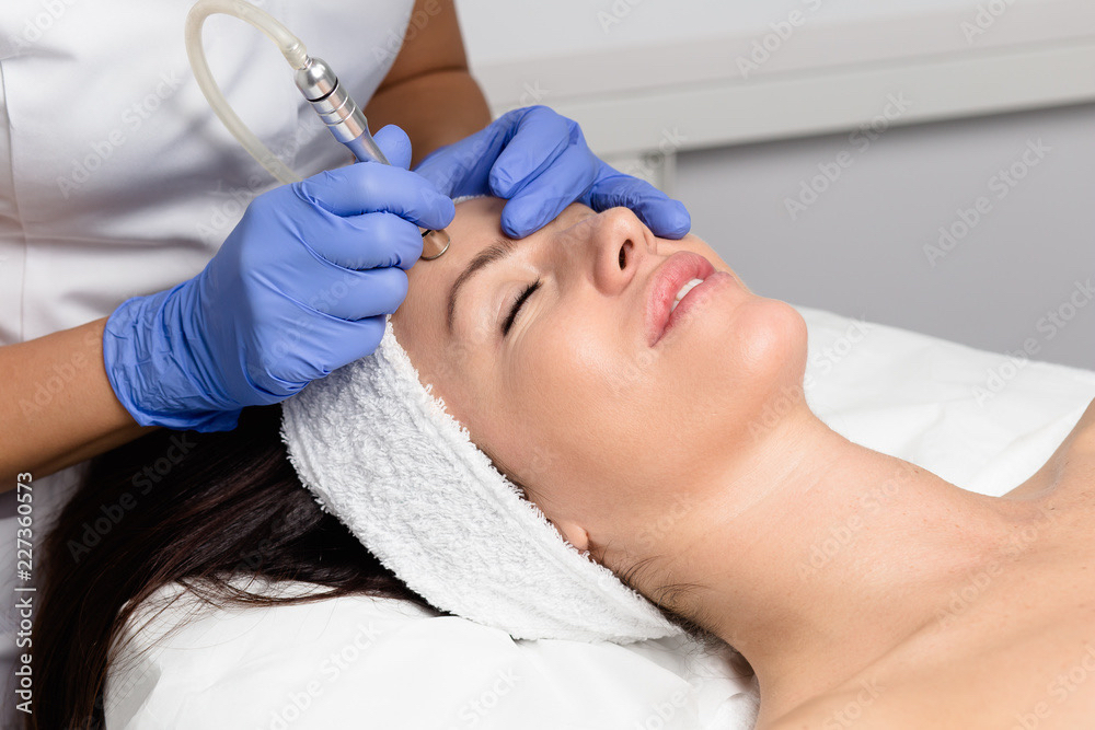 Microdermabrasion