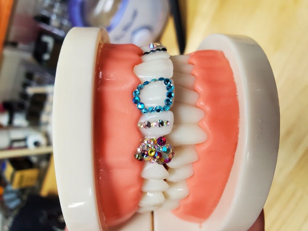 Toothgems