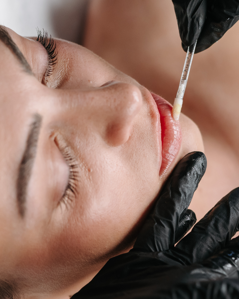 Lip Enhancement