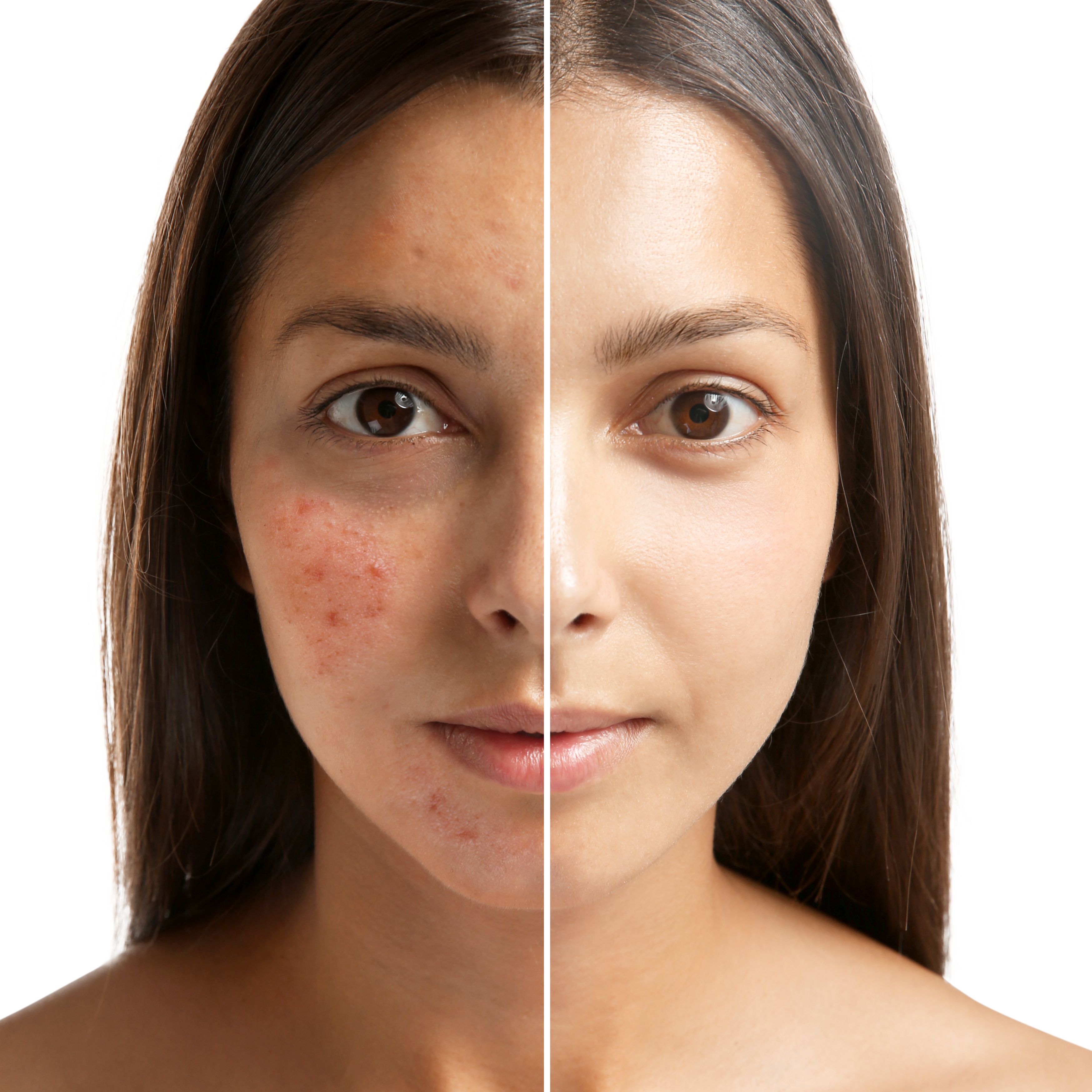 CLARIDAD at Metamorphix Skin in Gaithersburg, MD