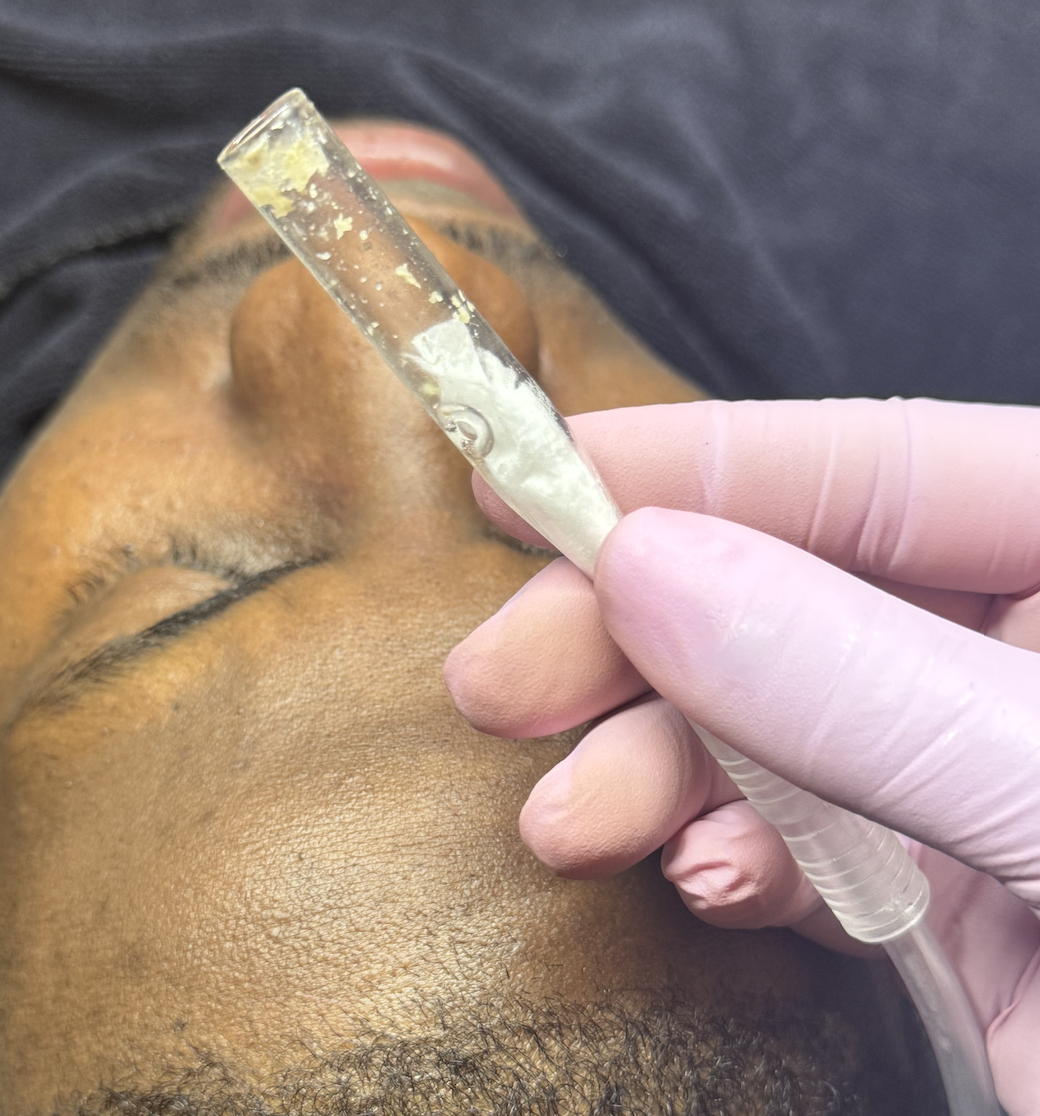 Hard Reset Facial