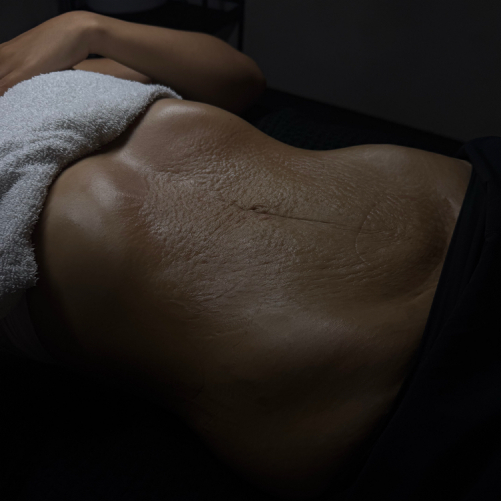 Lymphatic Massage at Liminluxx in Dallas, TX
