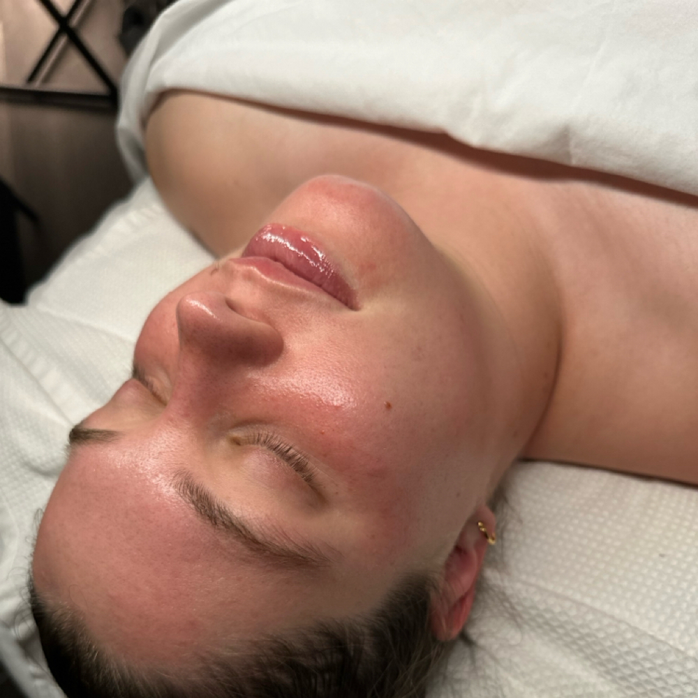 Nano Glow + FactorFive at The 1213 Skin Studio in Jacksonville, FL