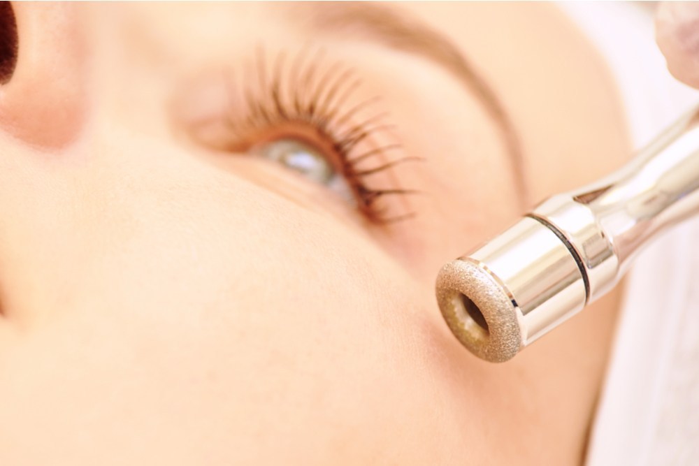 Microdermabrasion Facial