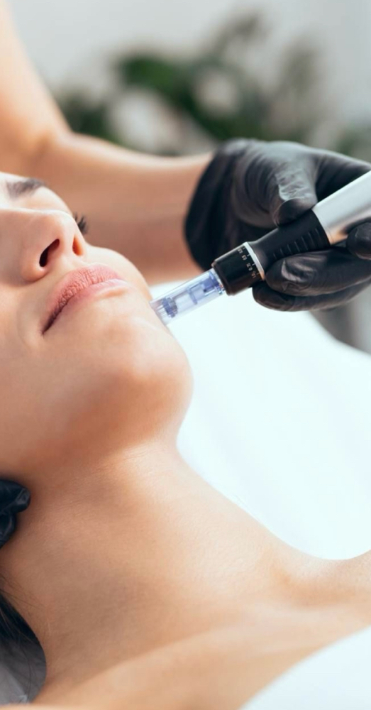 Microneedling Face Or Scalp