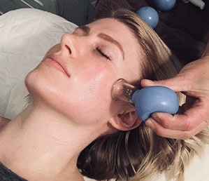 Face cupping add -on at Derma By Debbie in Rusk, TX