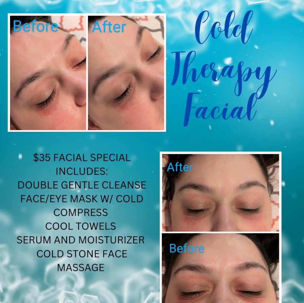 Cold Therapy Facial