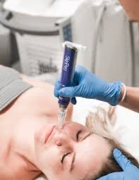 Microneedling: Plain/PRP/Specialty