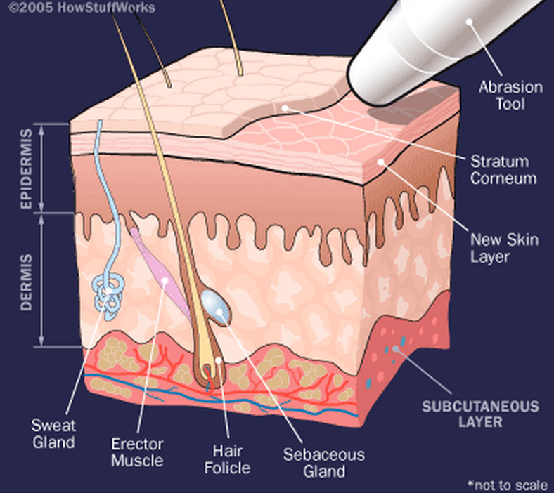 Microdermabrasion Add On