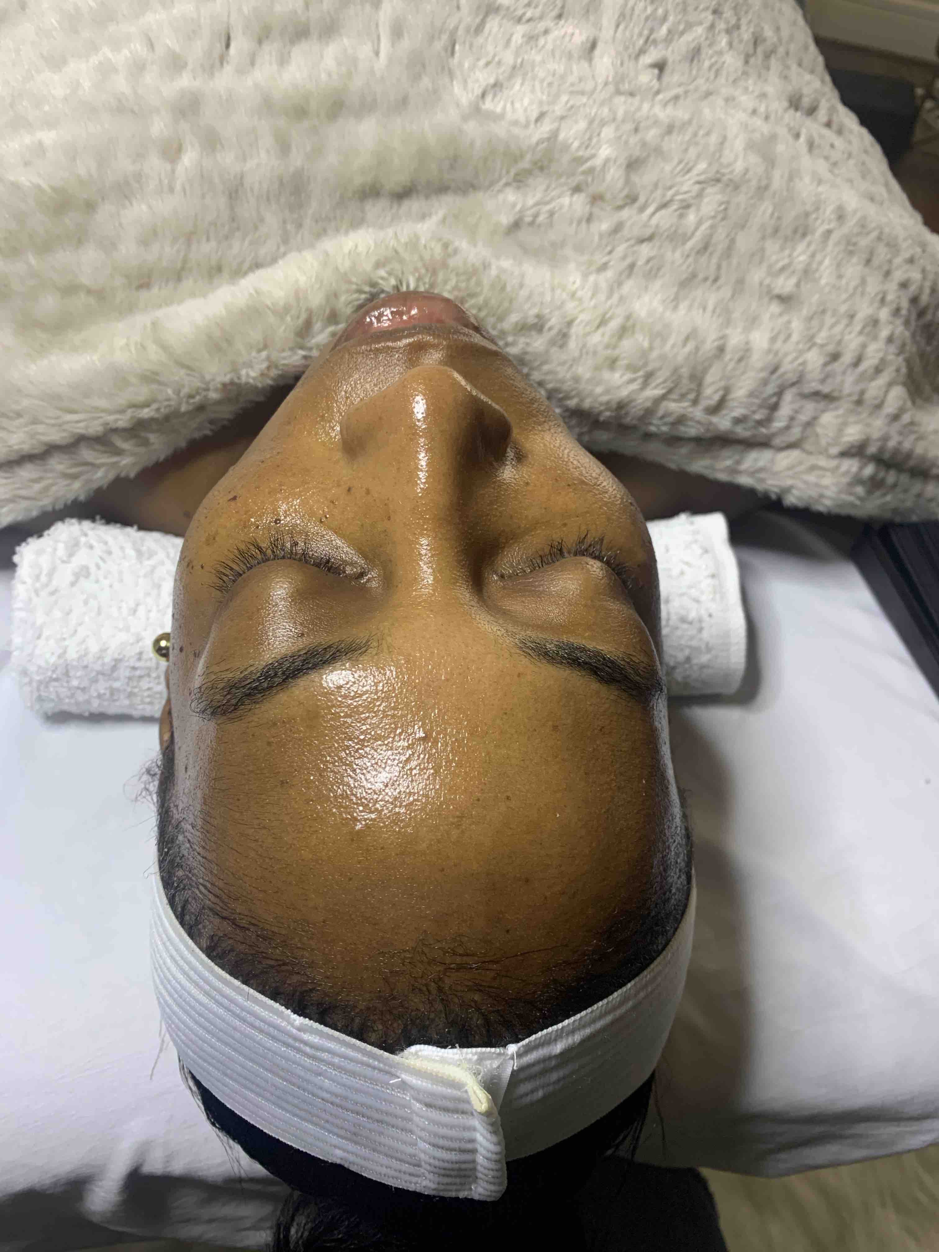 Oxygenating Peel
