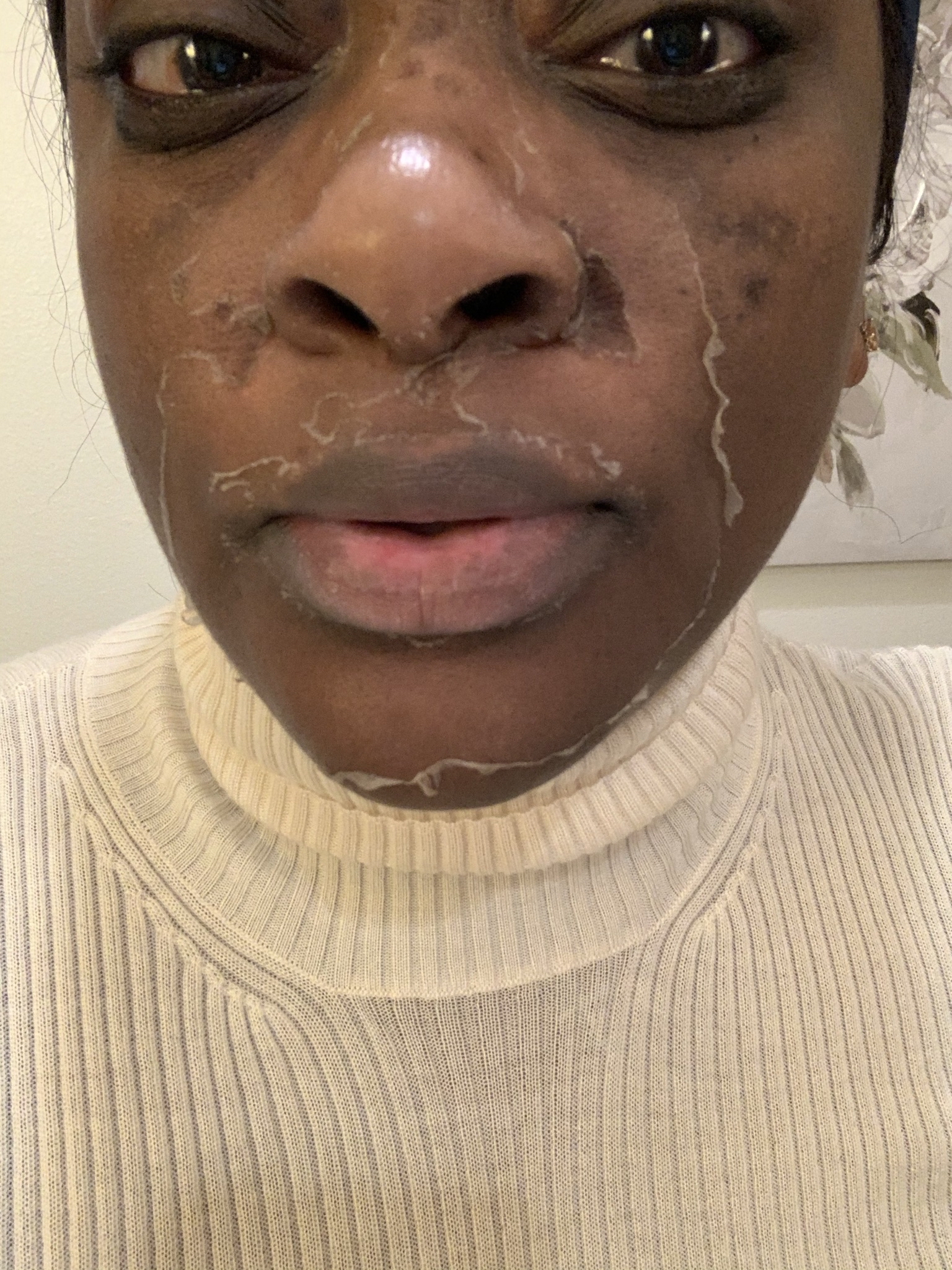 All Things Luxury Peel