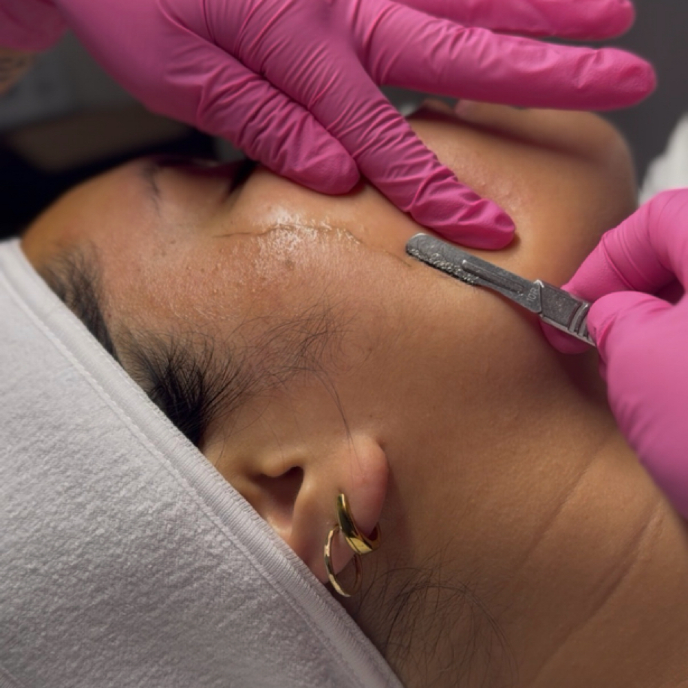 Bare & Bright Dermaplane Facial at Liv Beautiful Esthetics in CA, CA