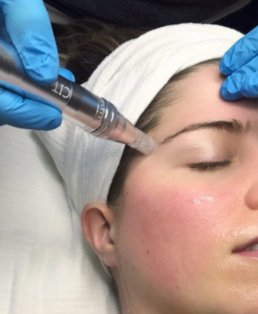 Nano Infusion add-on at DaisyEsthetics in Ukiah, CA