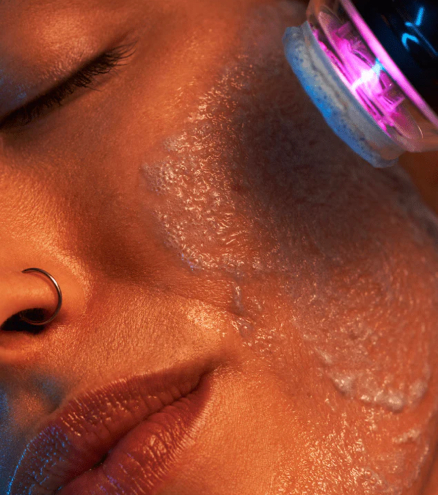 Glo 2 Facial-under arms