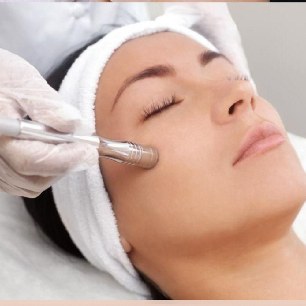 Microdermabration at Holistic Glow Esthetics in New Lenox, IL