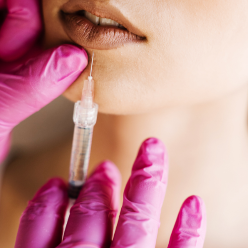 Lip Filler