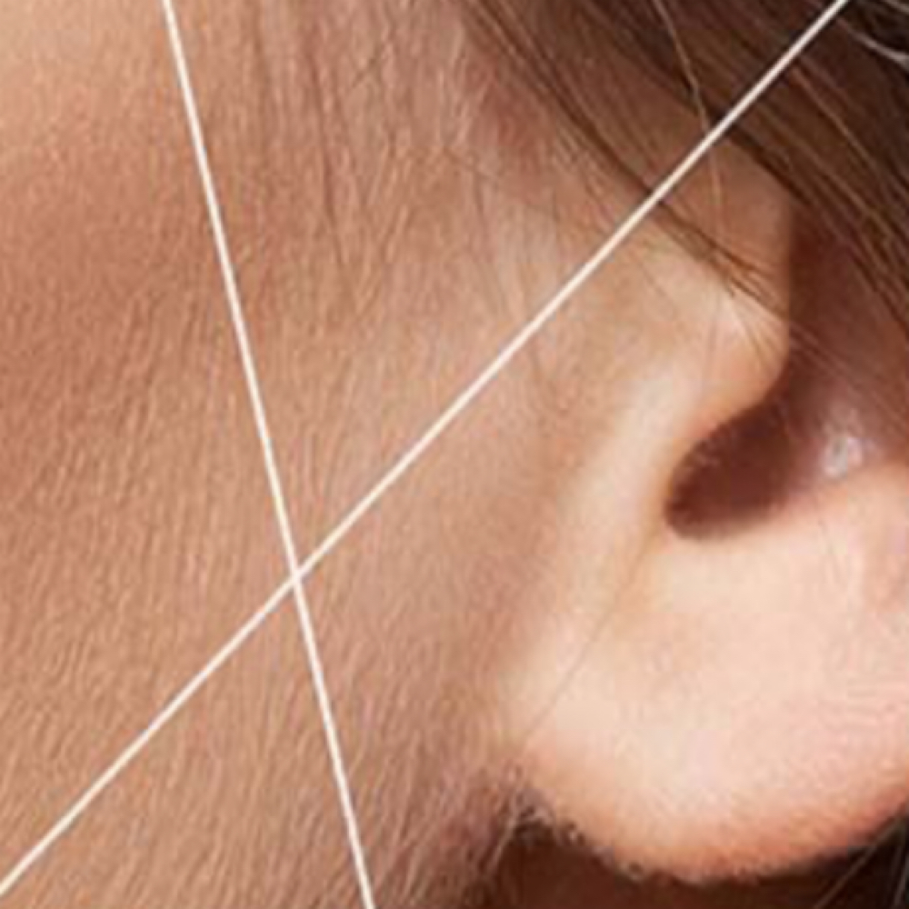 Sides at Aura Electrolysis | Laser | Threading in Ashland, MA