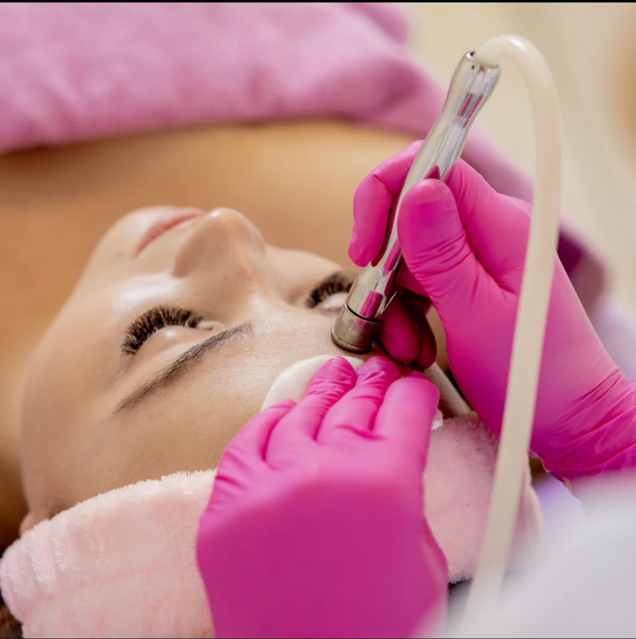 Microdermabrasion Facial