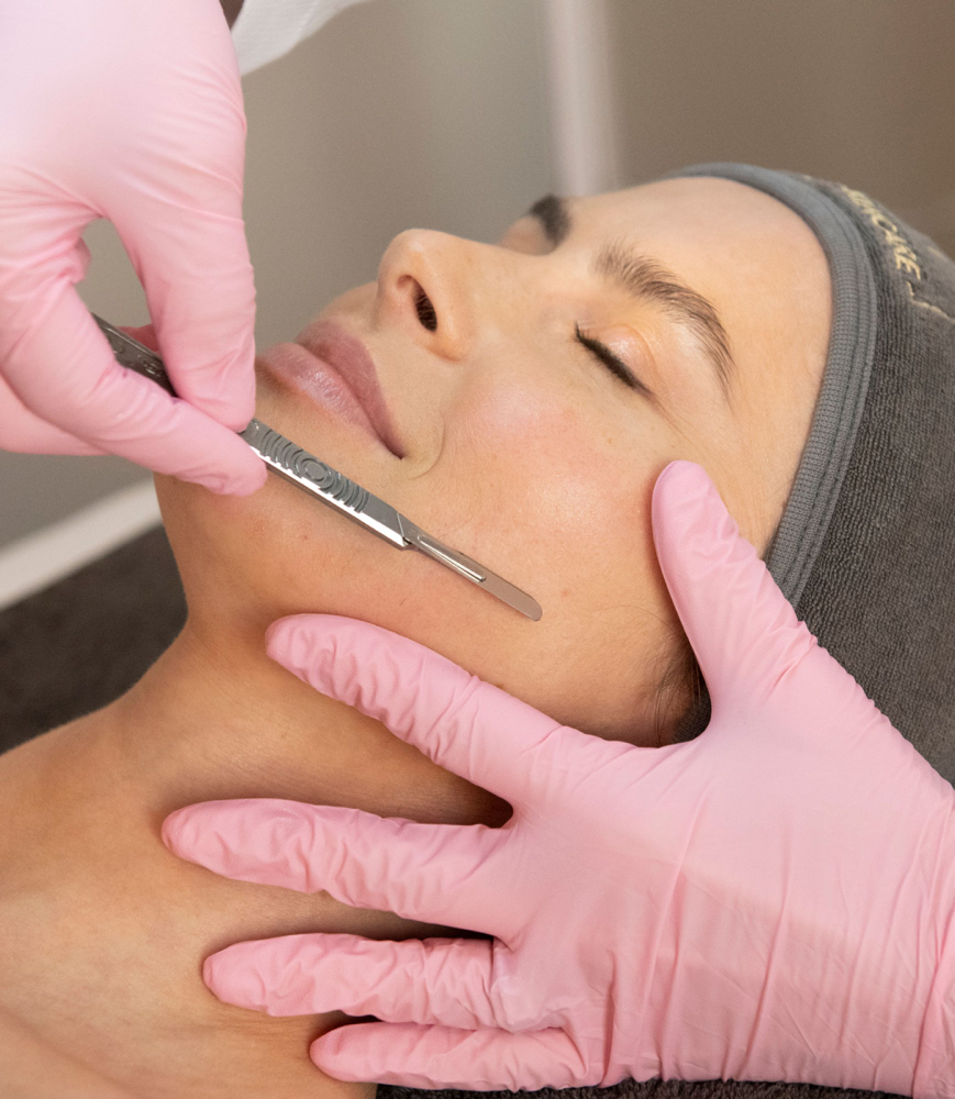 Dermaplane Facial