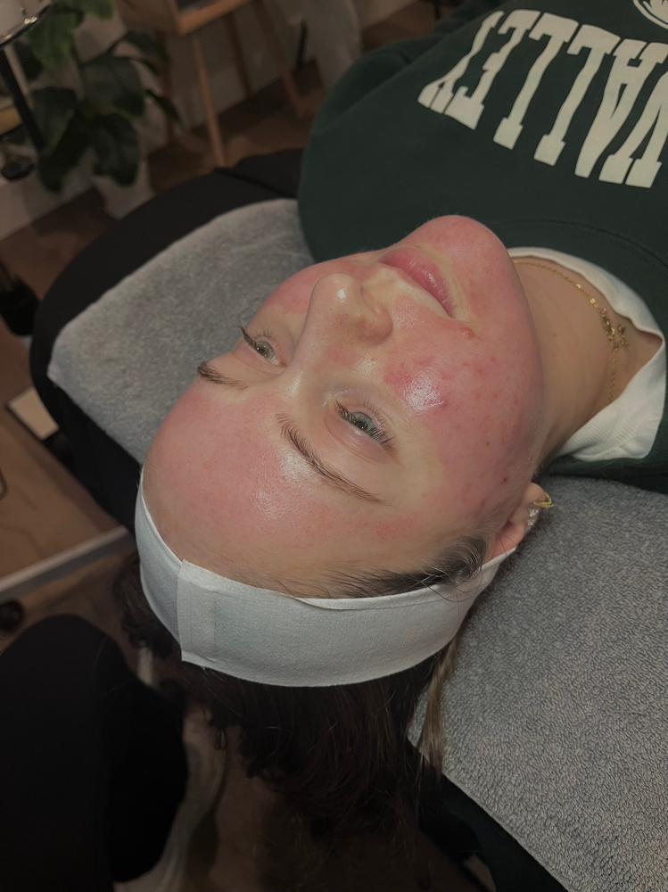 Package Of 3 Sessions Micro/Peel