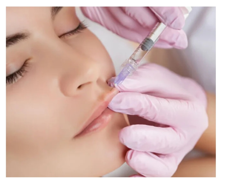 Lip Filler