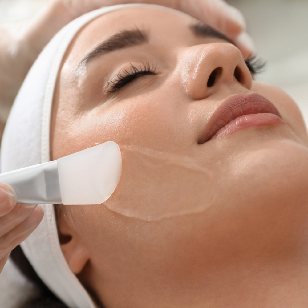 Hyperpigmentation Peel at Estética by Martha in Feasterville, PA