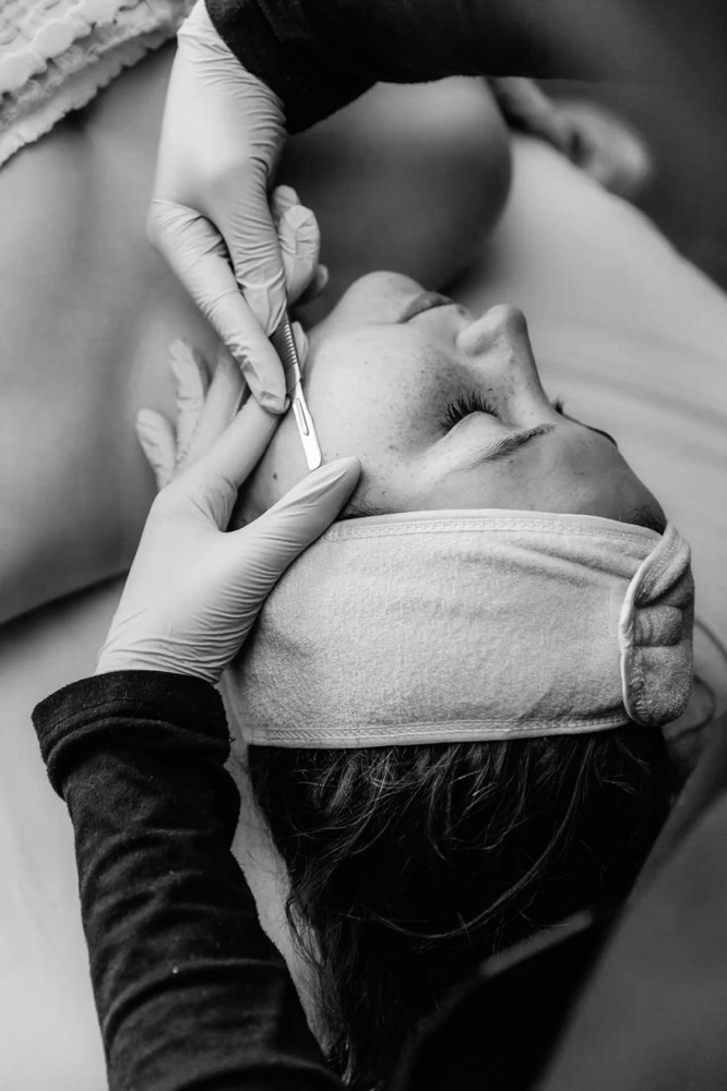 Dermaplaning at Skin by Giselle in Commerce City, CO