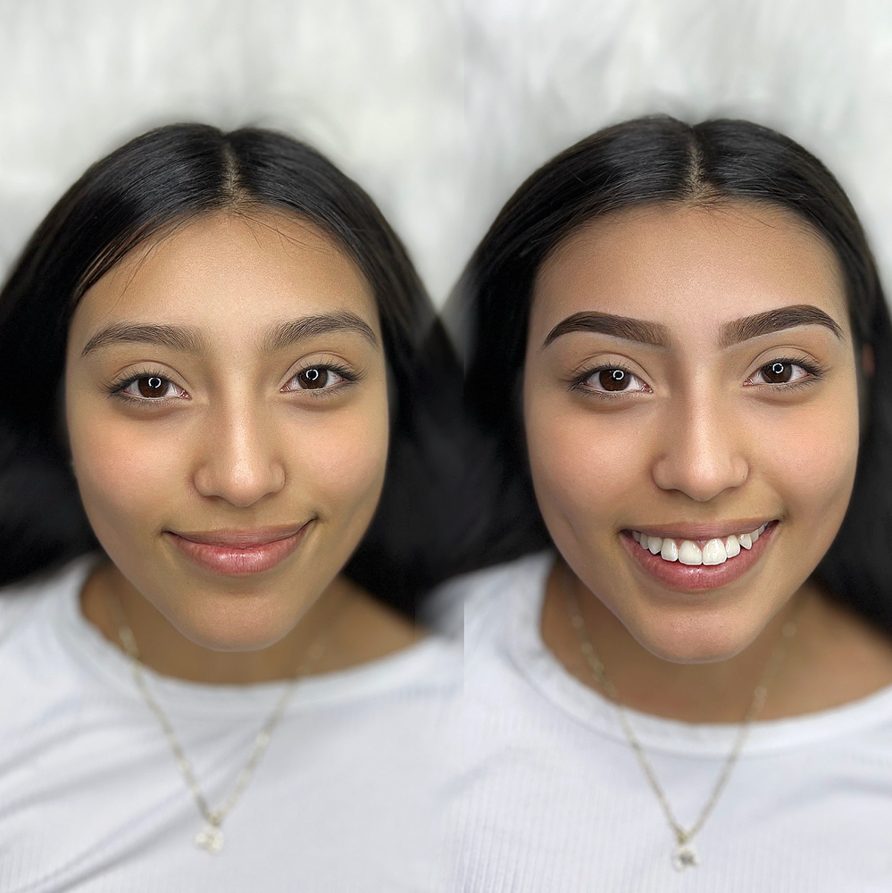 Brow Consultation