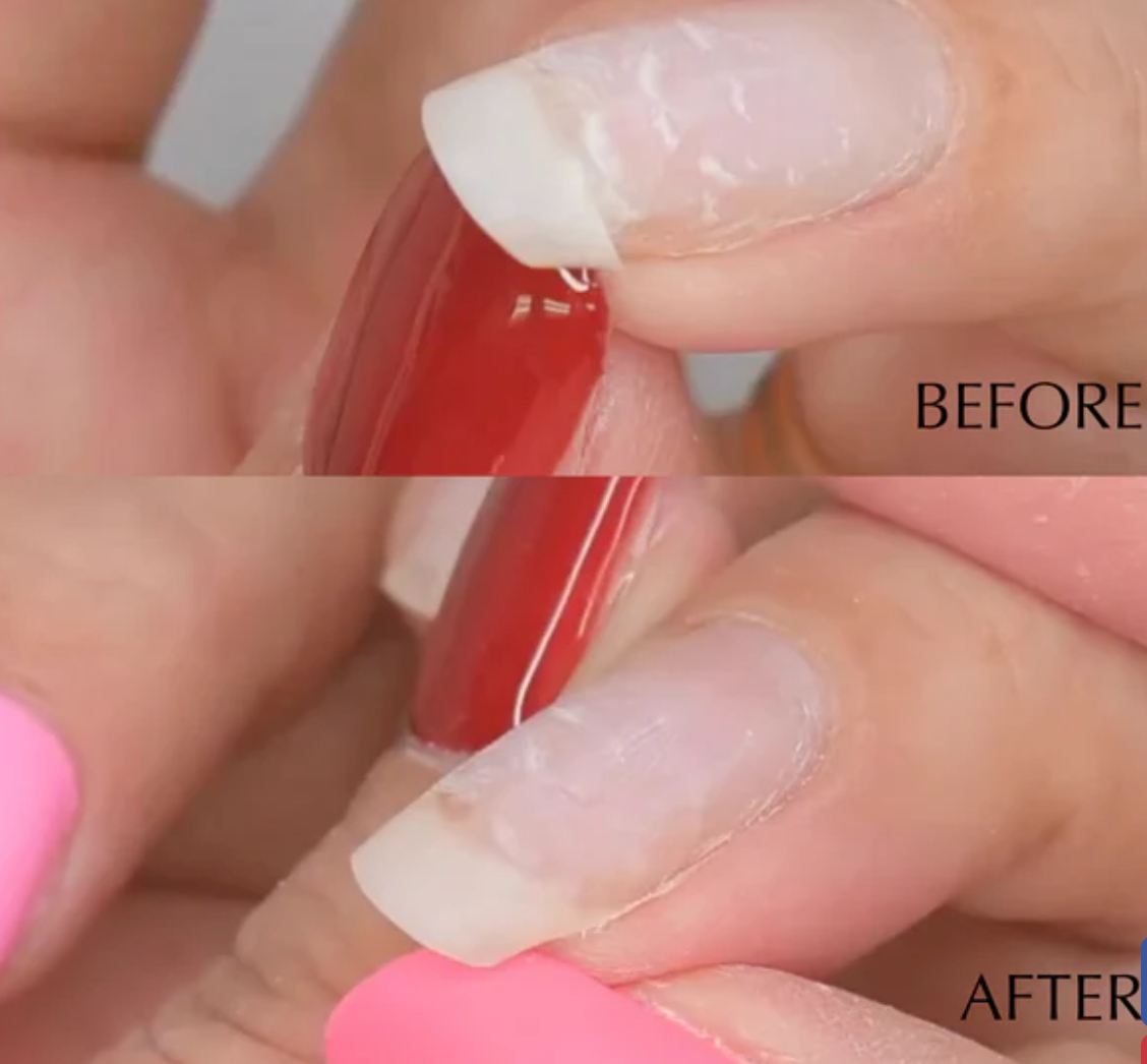 Nail repair