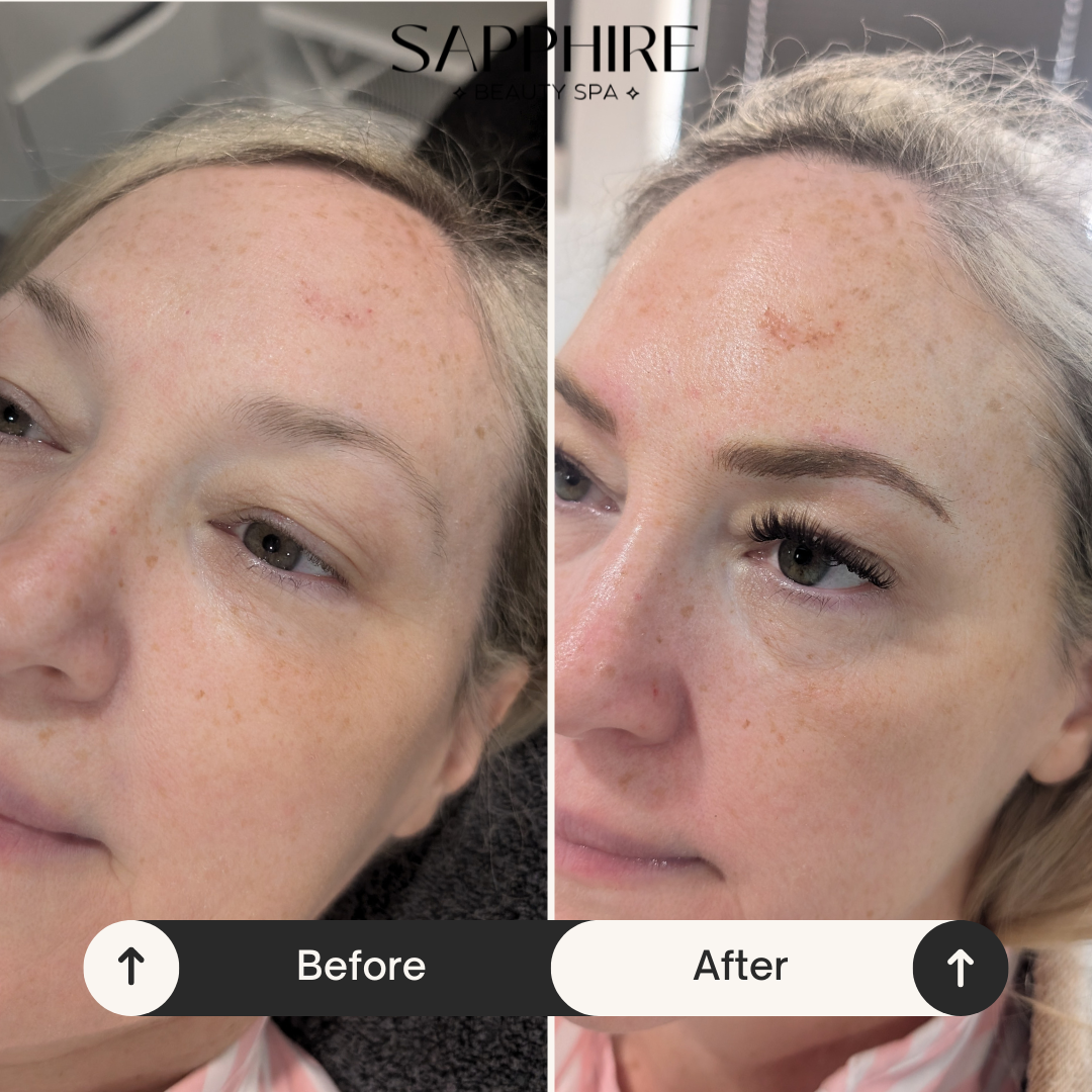 Microblading With Shading