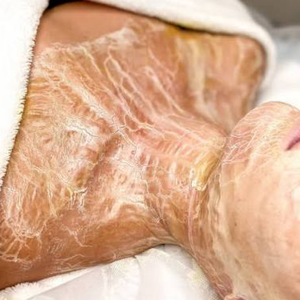 DMK Enzyme Therapy at Skn2Skn Aesthetics in Chicago, IL