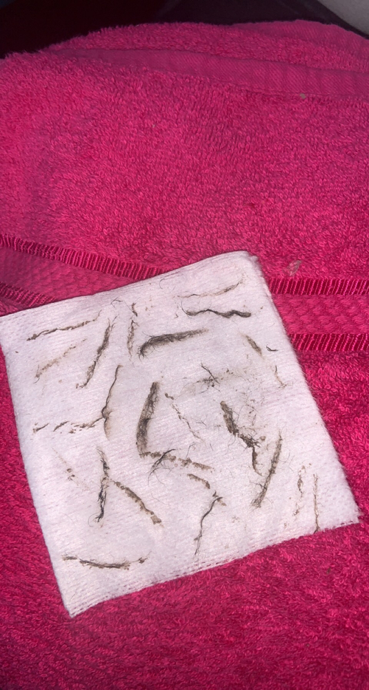 Dermaplaning Facial