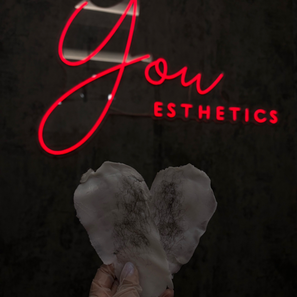 Full stomach/ Belly at You Esthetics in Salem, MA