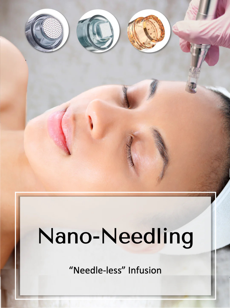 Nano-Needling