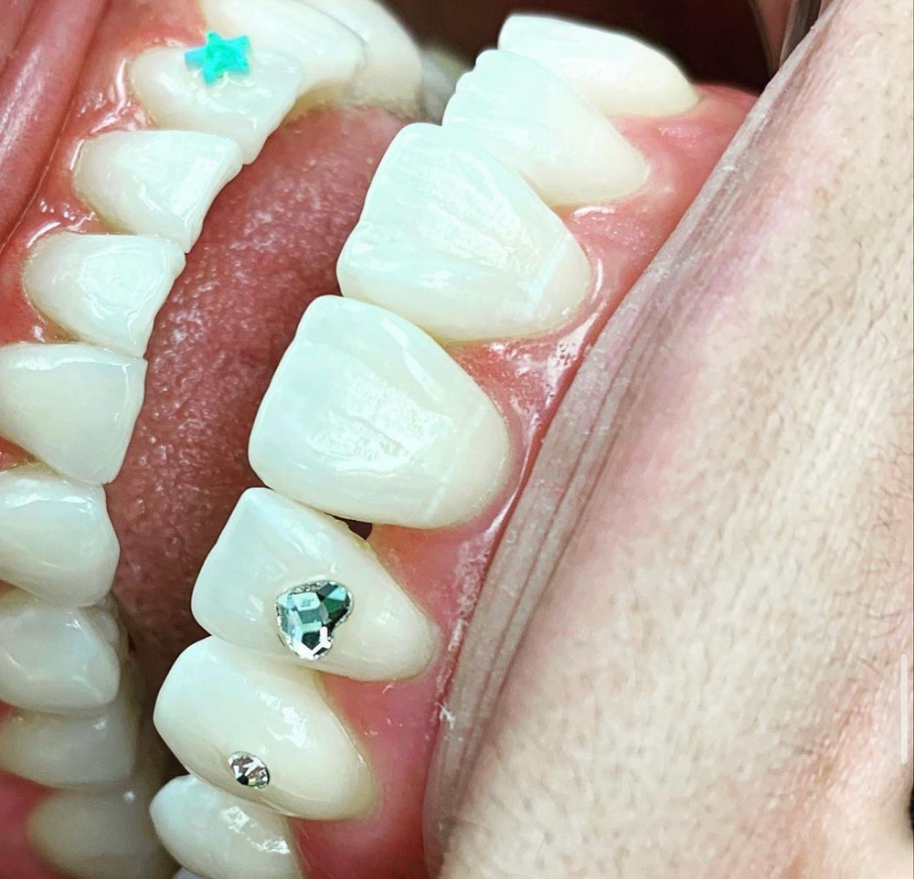 Tooth Gem at Onyx Beauty in Chesapeake, VA