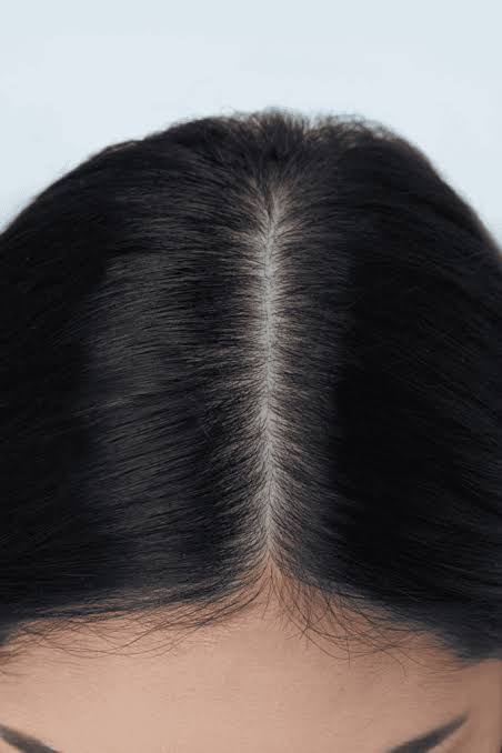 Scalp Treatment