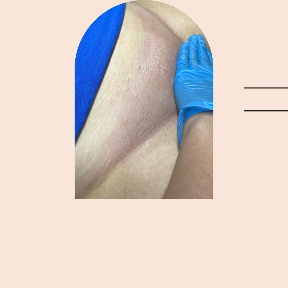 Brazilian Wax at Reverie Skin Lab in London, KY