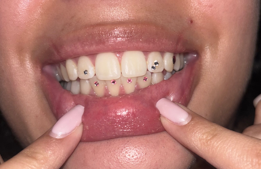 Tooth Gem (1 Gem)