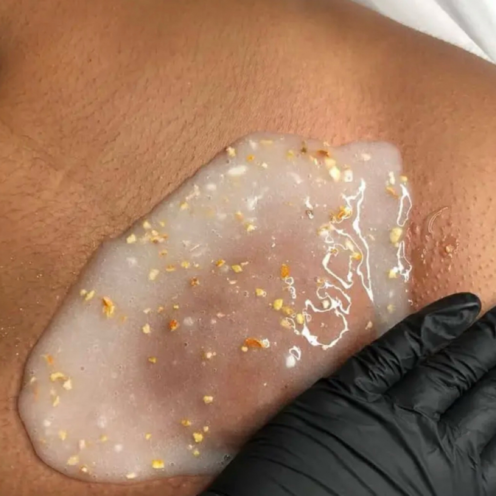 Vajacial at Honest Skin in North Palm Beach, FL