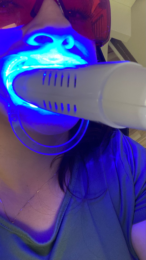 Teeth Whitening 30Min