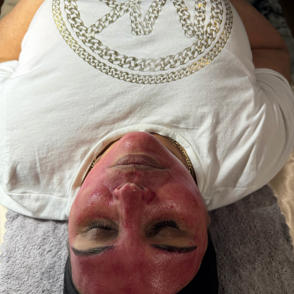 Mild Peel at Radiant Beauty By Selene in Fresno, CA
