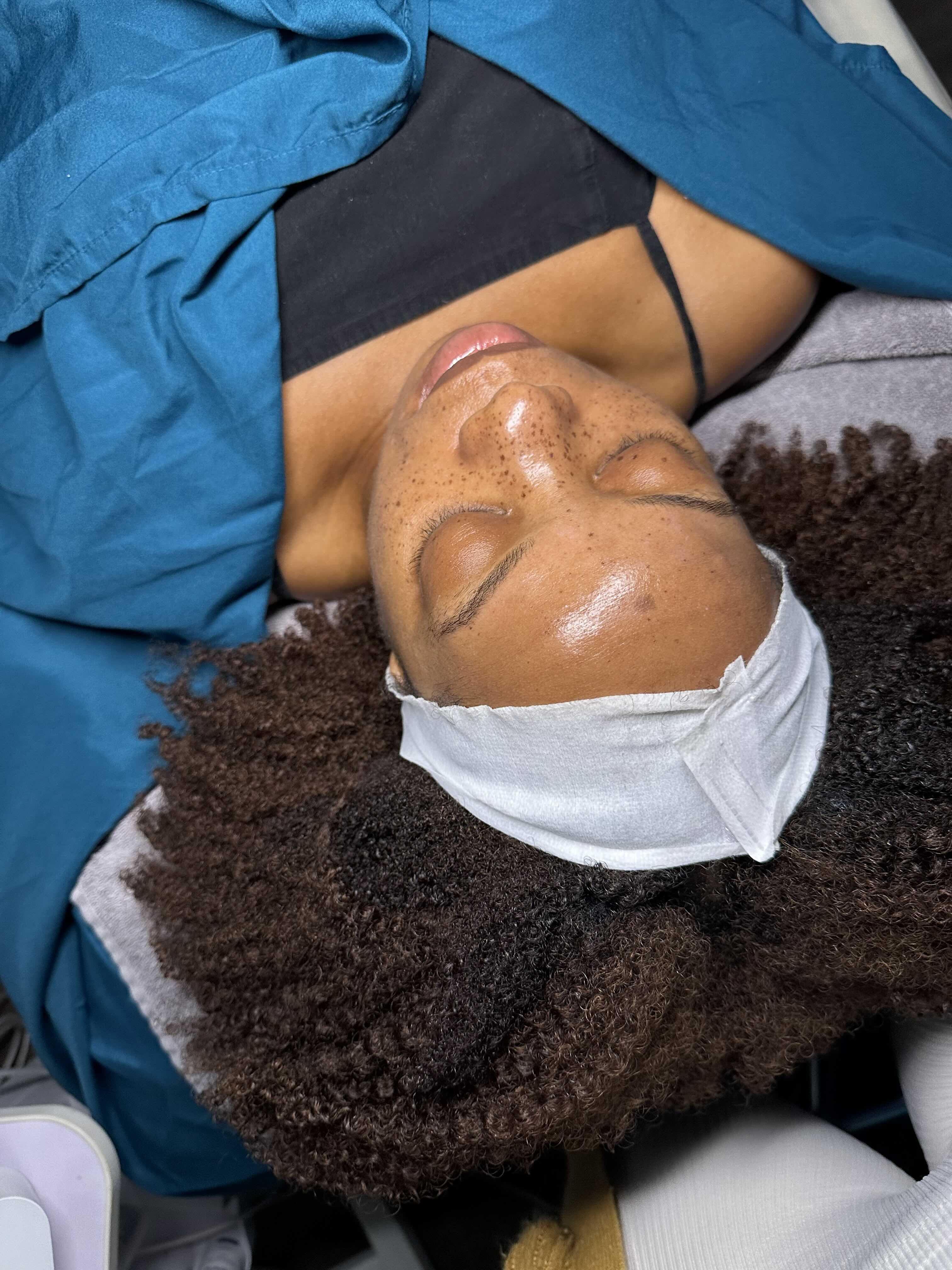 Collagen Induction Therapy