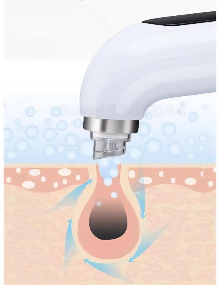 Pore Vacuum Cleansing ADD-ON