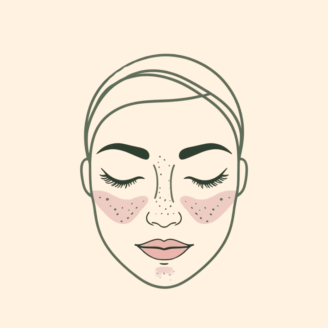 Hyperpigmentation Facial