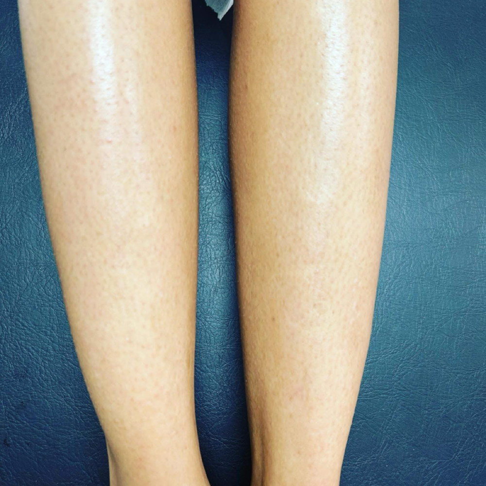 Full Legs Waxing at Forever Beauty Salon in Lexington, KY