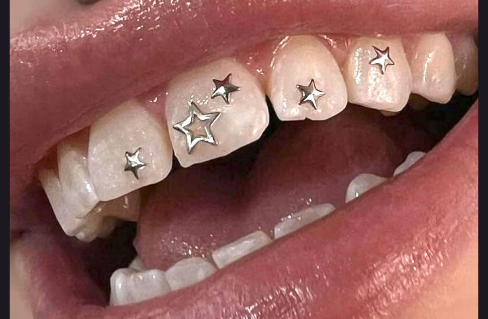 Smile Tooth Gems (coming soon)
