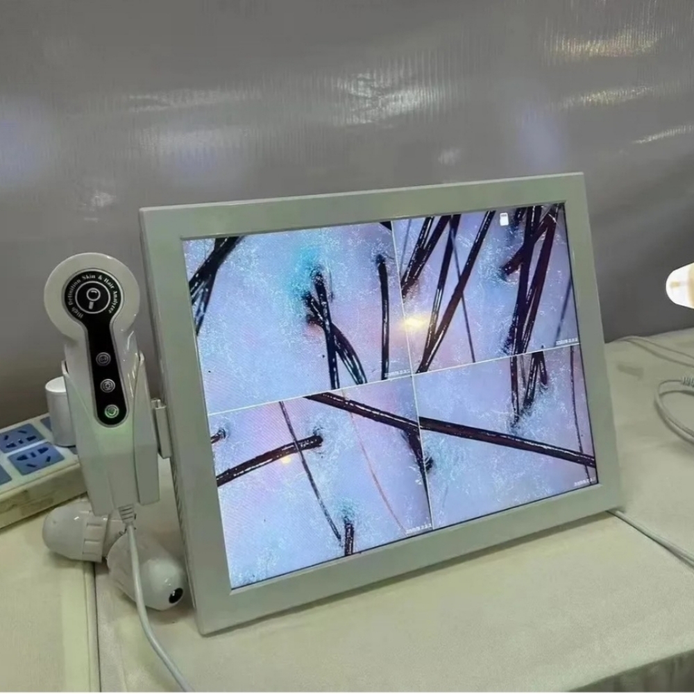 Scalp Analysis at A Better You Hair Studio LLC in Chattanooga, TN