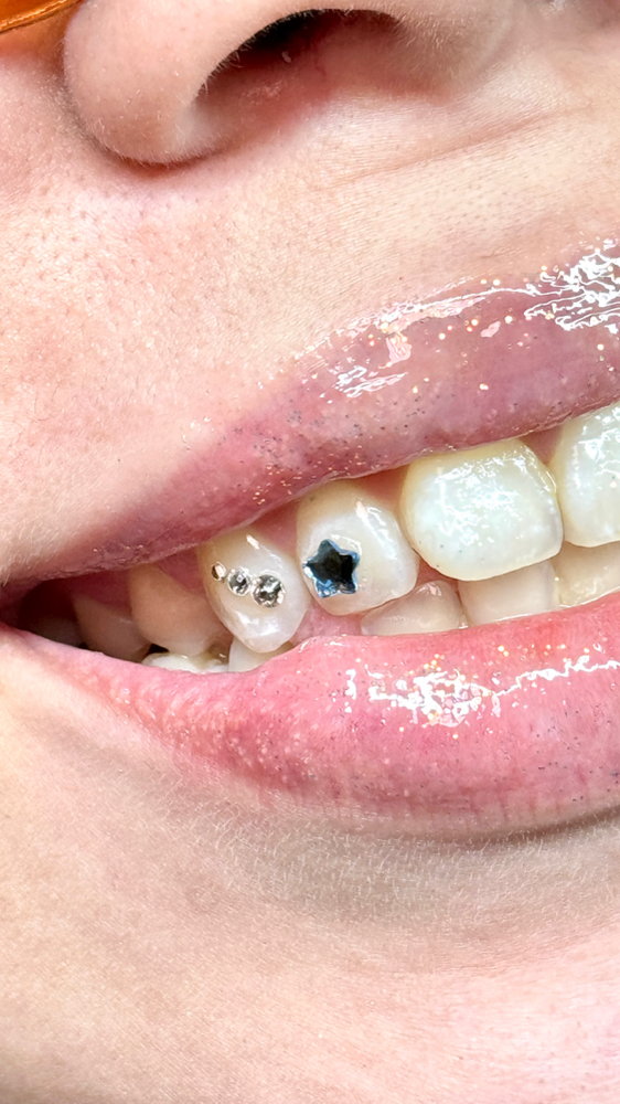 Tooth Gem/s